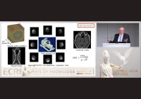 Cross-Sectional Imaging Gains Speed, Detail and Sensitivity