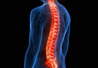 Spinal column inflammation visualisation highlighting vertebral pathology and musculoskeletal pain assessment.