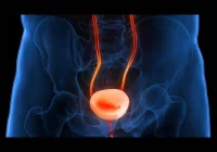 Medical illustration of the urinary system highlighting the bladder and ureters, indicating urological pathology, inflammation or diagnostic focus within lower urinary tract assessment.