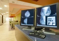 Digital mammography images on radiology monitors supporting breast imaging analysis and clinical decision-making.