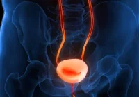 Medical illustration of the urinary bladder and ureters with highlighted pathology, illustrating urological anatomy and imaging-based assessment of lower urinary tract conditions.