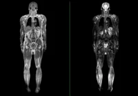 Whole-body medical imaging scan, supporting radiology assessment, disease screening, diagnostic evaluation and precision healthcare planning.