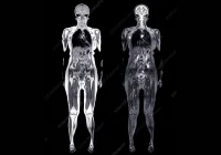 Whole-body MRI scan showing coronal views, supporting radiology assessment, disease detection, oncology staging and precision care planning.