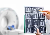 Clinician reviewing chest CT images, supporting pulmonary diagnosis, radiology assessment and respiratory care planning.
