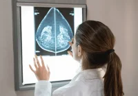 Clinician reviewing mammography image, supporting breast screening, diagnostic imaging and women’s health assessment.