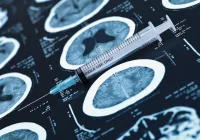 Syringe with brain MRI scans, supporting neurological treatment, interventional care, diagnostic imaging and clinical decision-making.