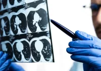 Clinician reviewing chest CT scans, supporting lung imaging, diagnostic assessment, respiratory care and clinical decision-making.