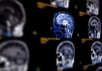 Patient undergoing head imaging, supporting CT workflow, neurodiagnostic assessment, radiology services and patient care coordination.