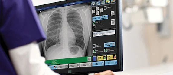 Carestream Digital X-ray System Receives Top Award