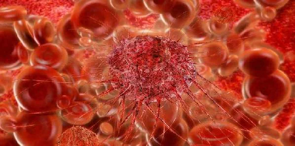 Innovative Prognostic Test for E2F4 in Breast Cancer