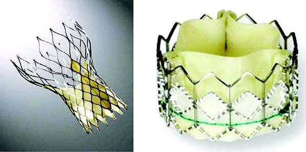 TAVR Surgery and Vascular Complications