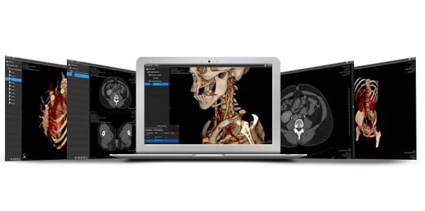Calgary Scientific’s ResolutionMD 4.0 Extends Access to Non-DICOM Data 