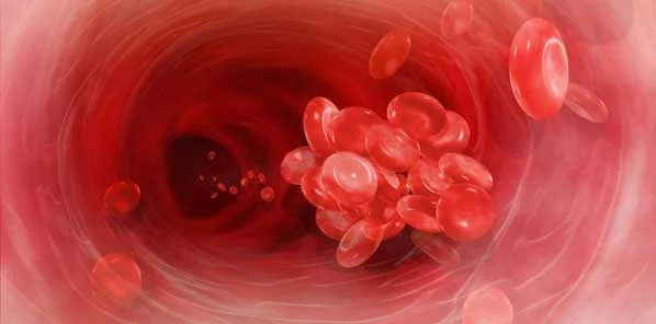 Blood Clot 'Vacuum' Avoids Open Heart Surgery