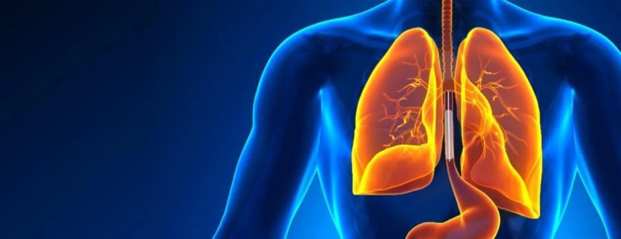 Accurately Setting PEEP with Transpulmonary Pressure