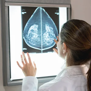 AI Breast Cancer Diagnosis Matches Two Doctors 