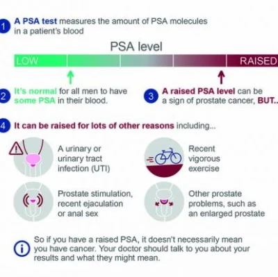 Prostate is Now Most Common Cancer
