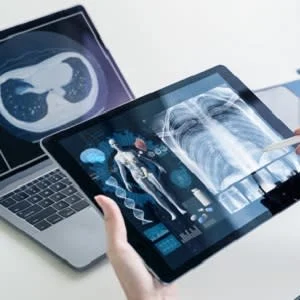 Mobile X-rays Valuable for COVID-19 Patients