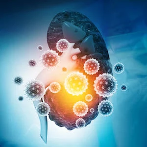 AKI in Critically Ill Patients With COVID-19