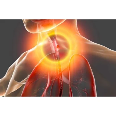 AI System Helps Physicians Classify Oesophageal Lesions