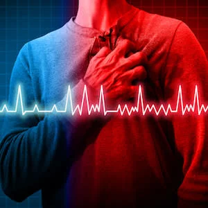 CVD Risk Profiles in Secondary Prevention Not Improving