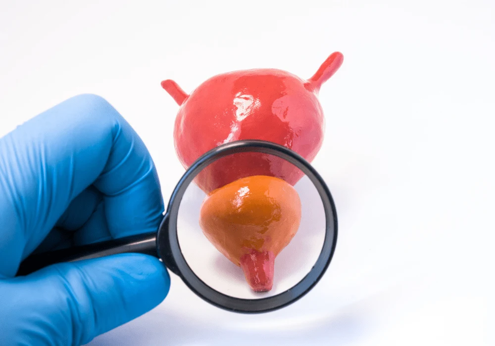 Evaluating the Performance of AI-Based Software in Prostate MRI