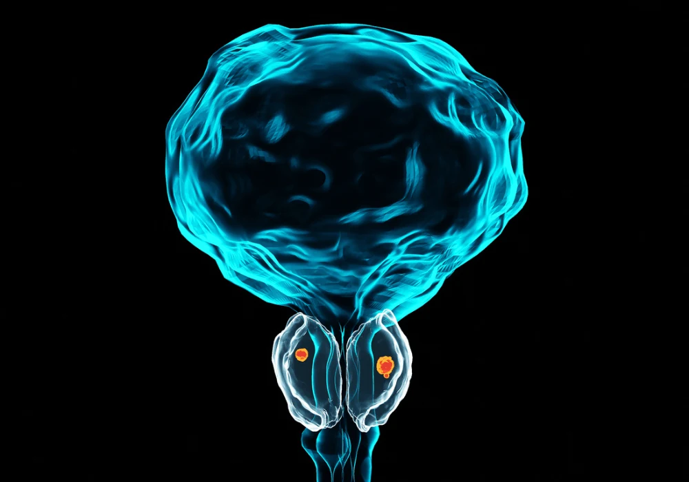 How to Enhance Prostate Cancer Diagnosis with Radiomics