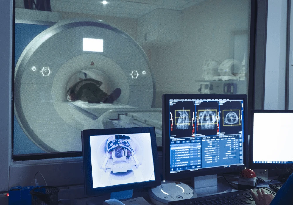 Interstitial Lung Abnormalities: Insights from Routine CT Scans