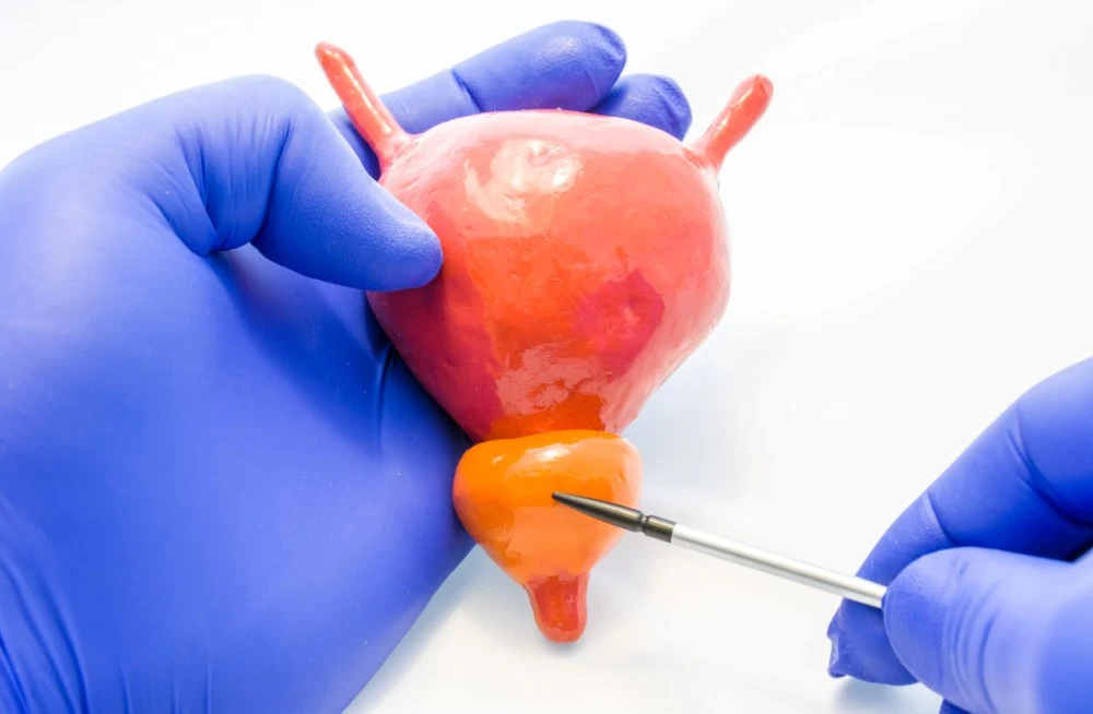 Optimising Prostate Cancer Diagnosis with MRI-Based Risk Stratification