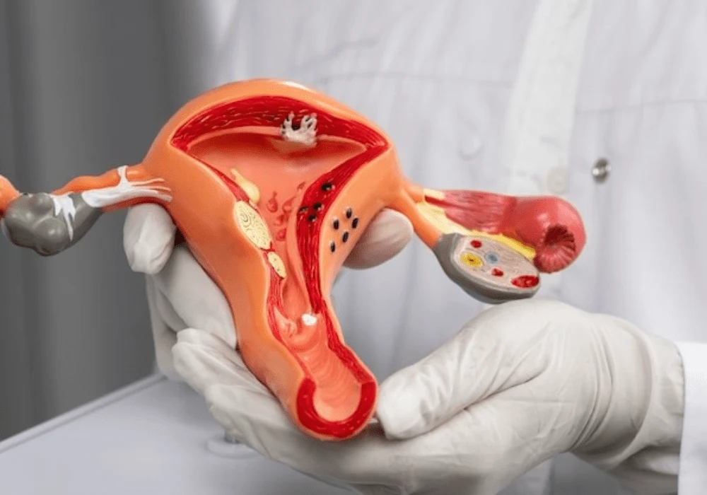 Doctor holding anatomical model of female reproductive system for medical education 