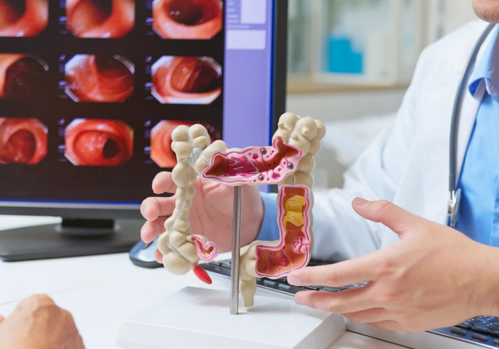 Doctor explaining colon health using anatomical model and colonoscopy images 