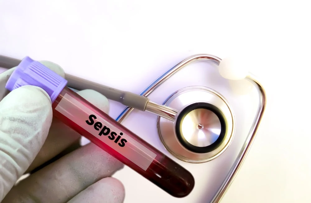 Metabolic Shifts Precede Sepsis Organ Dysfunction