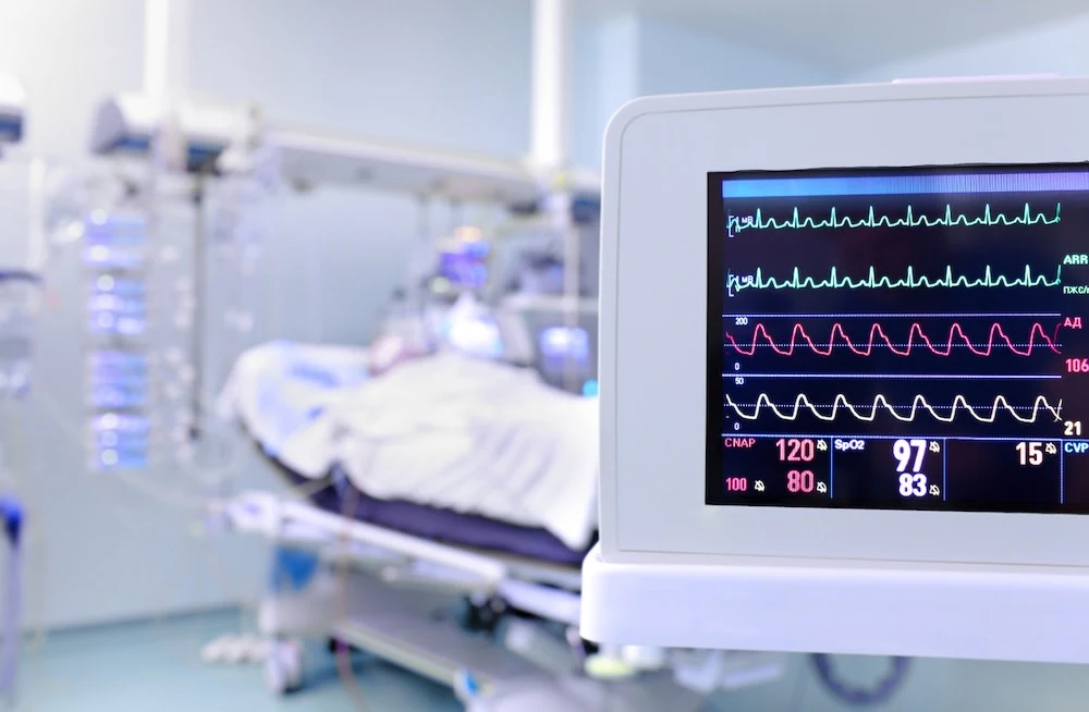 Extracorporeal CPR for Refractory Cardiac Arrest