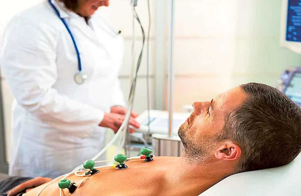 Peri-Operative Myocardial Infarction: Cardiologist Evaluation and Outcomes