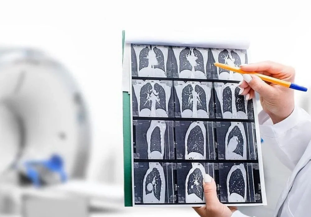 Radiologist showing tomography scan of a patient's lungs over of CT machine.