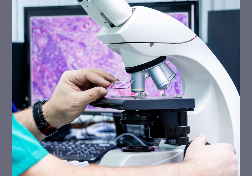 Laboratory microscope in use for histopathological analysis, with a tissue slide positioned on the stage and a digital pathology image displayed on a monitor in the background, illustrating modern diagnostic workflows in clinical and research settings.