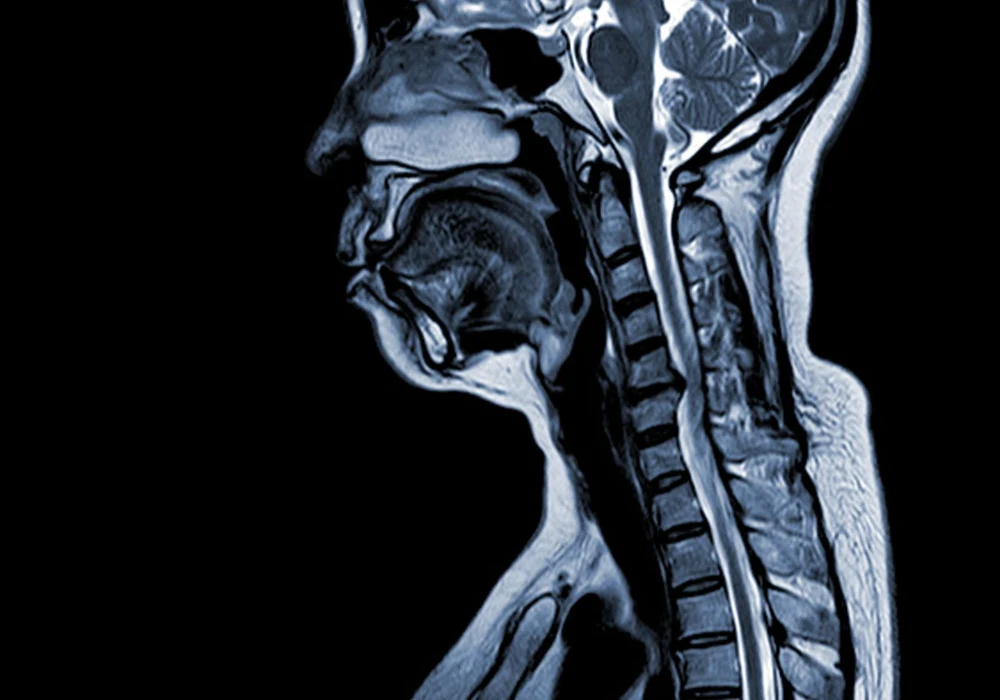Sagittal brain and cervical spine MRI scan demonstrating detailed neuroimaging for clinical assessment.