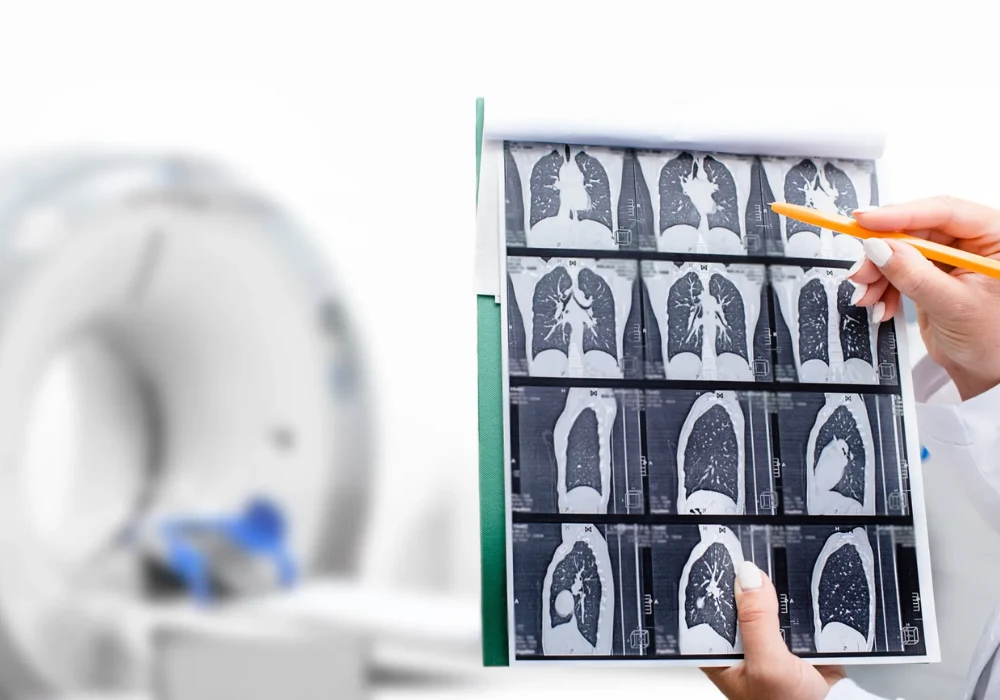 Clinician reviewing chest CT scan images for lung disease assessment, radiology diagnosis and respiratory care.