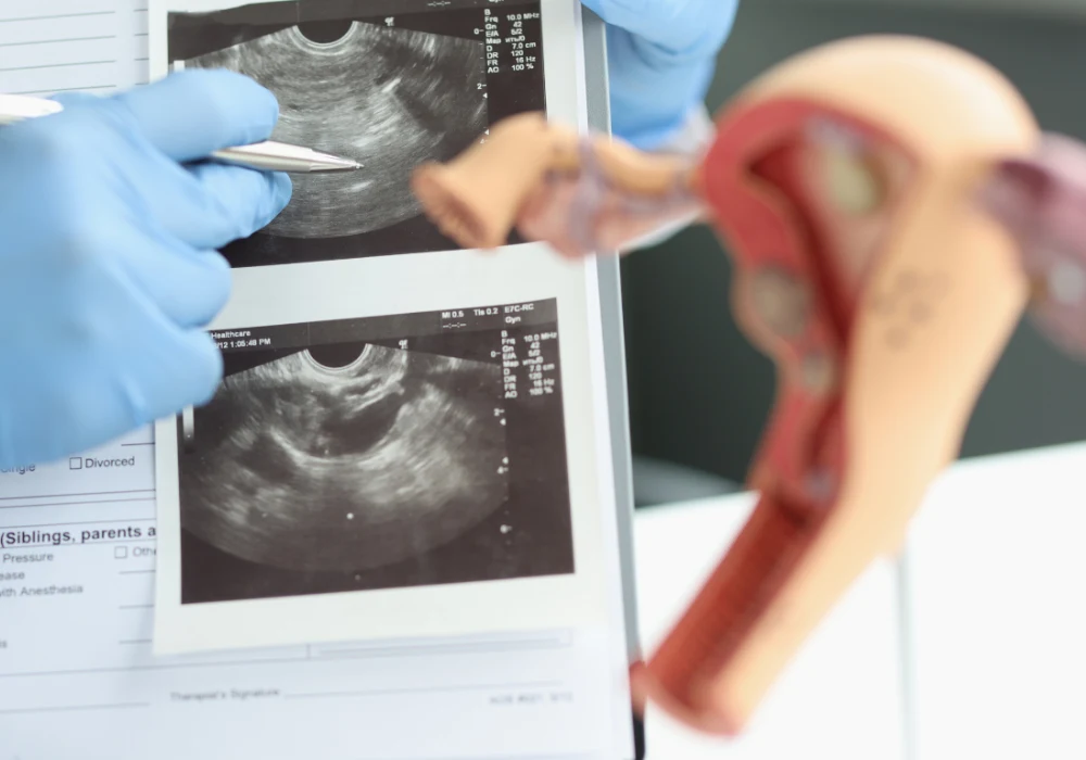 Gynaecological ultrasound scan with pelvic measurements, supporting women’s health assessment, diagnostic imaging and clinical decision-making.