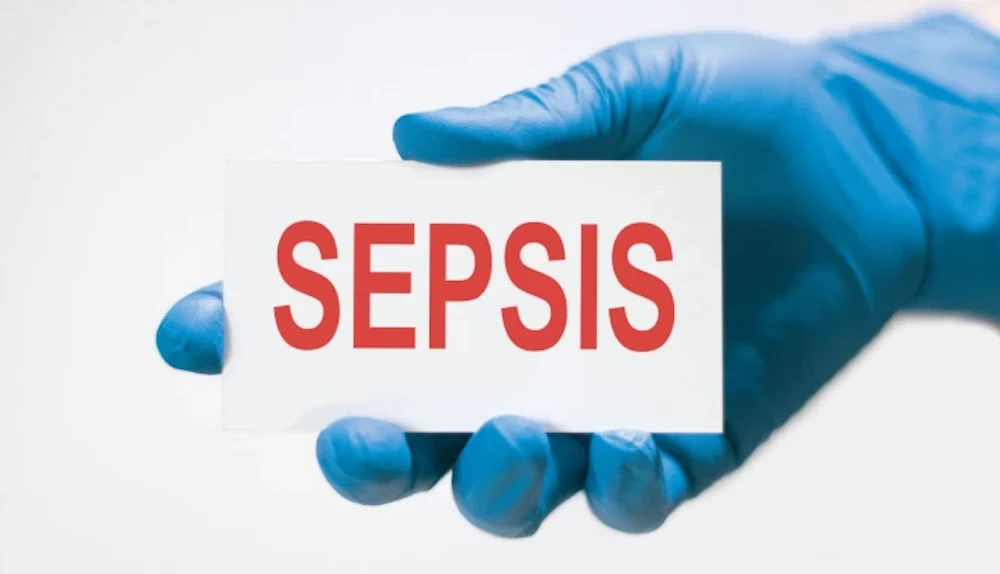 Immune Response in Sepsis as a Target