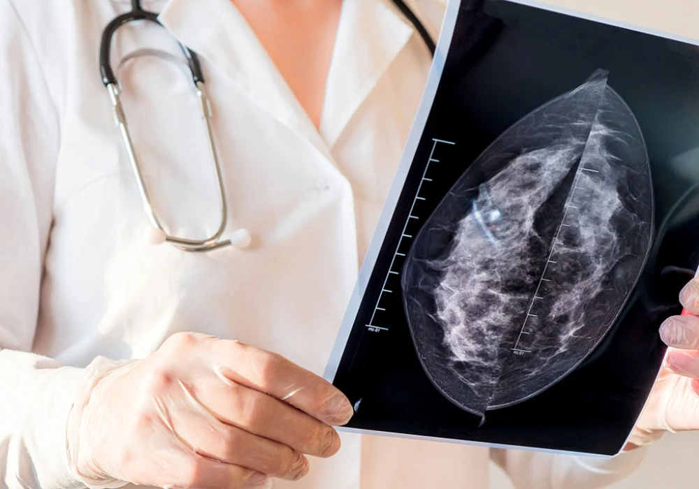 CEM Lesion Conspicuity Fails to Predict Malignancy