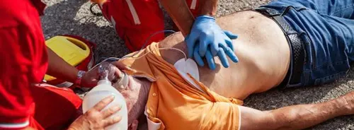 VAP, VAC, IVAC and Ventilator-Associated Events: The Need for Objectivity  for Surveillance