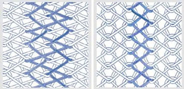 Vascular stent graft / abdominal / polyester INTERGARD MAQUET Vascular stent graft / abdominal / polyester INTERGARD MAQUET