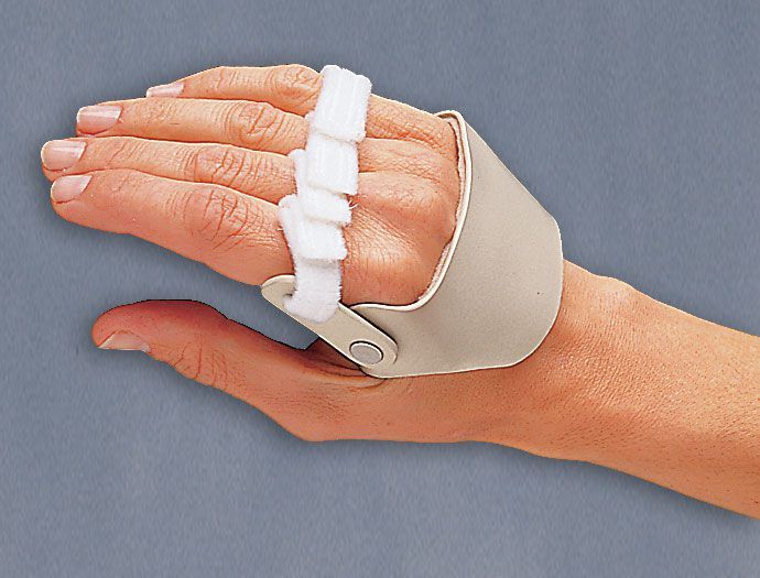 Health Management and Leadership Portal Metacarpal splint (orthopedic