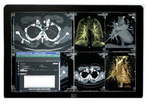 Health Management and Leadership Portal | Radiology information system RIS  SYNAPSE® TELERADIOLOGY FUJIFILM Europe | HealthManagement.org