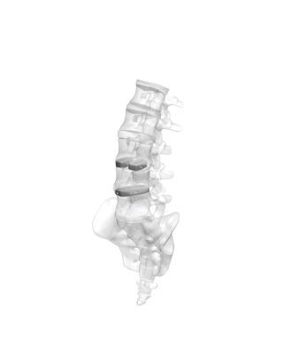Thoraco-lumbo-sacral interbody fusion cage / posterior MectaLIF - PLIF Medacta Thoraco-lumbo-sacral interbody fusion cage / posterior MectaLIF - PLIF Medacta