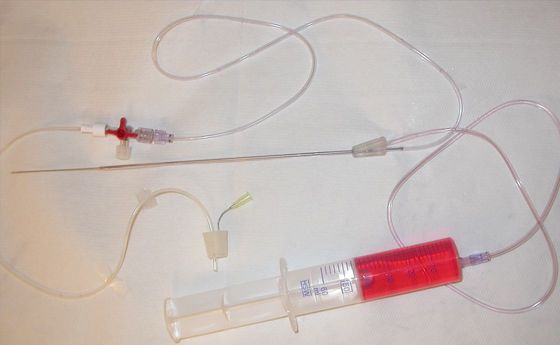 Ovocytarian puncture needle STEINER-TAN IVFETFLEX Ovocytarian puncture needle STEINER-TAN IVFETFLEX