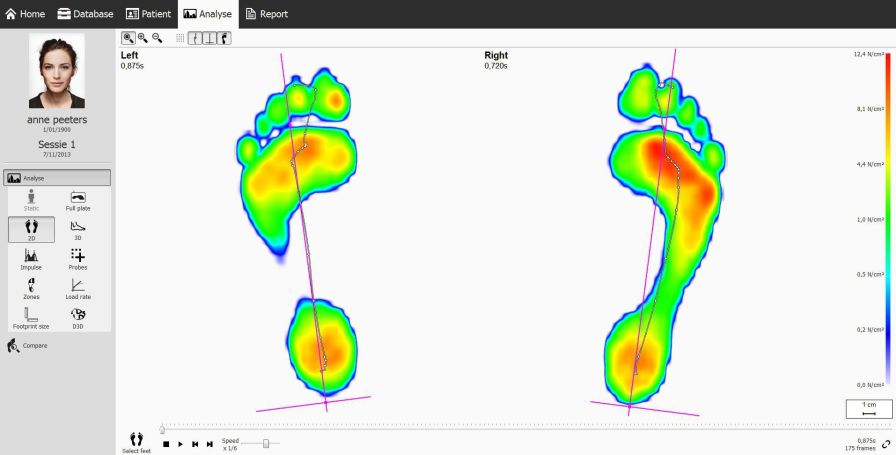 Health Management And Leadership Portal Gait Functional Capacity