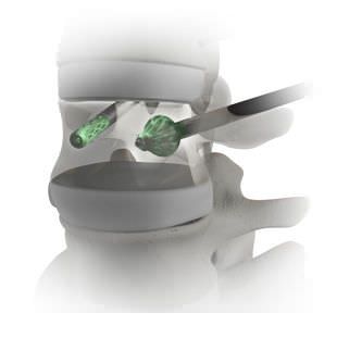 health-management-and-leadership-portal-spine-augmentation-system