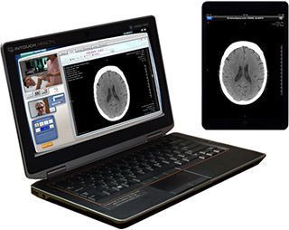 Diagnostic software / viewing / for telemedicine / for PACS SurePACS® InTouch Health Diagnostic software / viewing / for telemedicine / for PACS SurePACS® InTouch Health