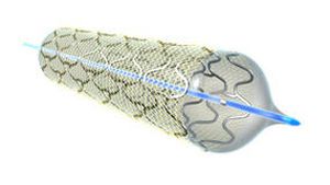 Coronary stent / stainless steel / with applicator MGuard InspireMD Coronary stent / stainless steel / with applicator MGuard InspireMD